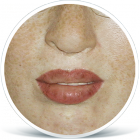 rozstep_po_zena