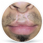 rozstep_pred_muz