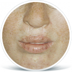 rozstep_pred_zena