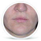rozstep2_PRED_zena